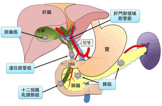 胆道・膵臓領域の悪性腫瘍発生部位